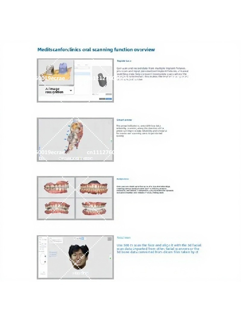 High-Quality Intraoral Scanner - Outdoor Furniture Quality ulasan dan harga